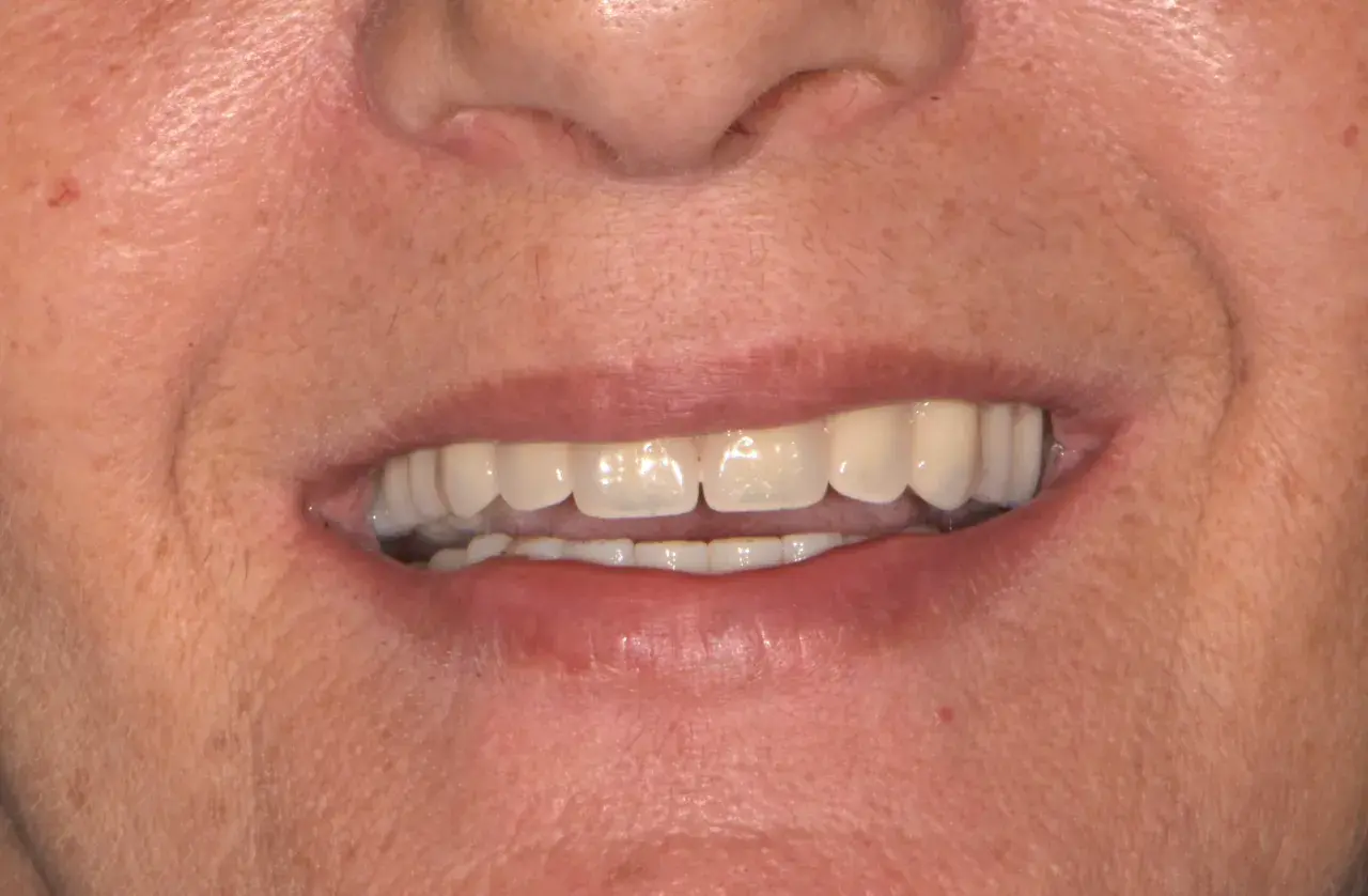 Un sorriso smagliante, ma attenzione: il tè macchia i denti.