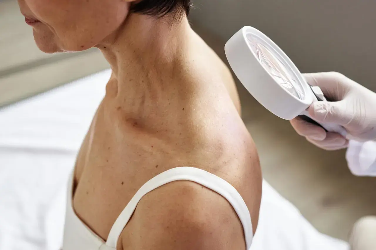 Dermatolog ogląda skórę szyi i ramienia pacjentki przez lupę.