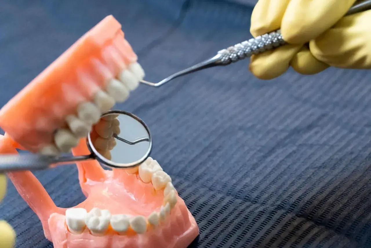 Model szczęki z widoczną próchnicą z boku zęba, badany lusterkiem dentystycznym.