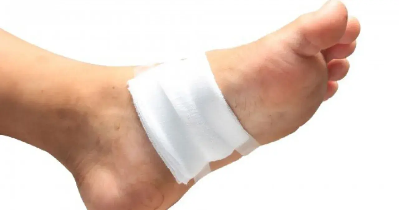 Un pansement blanc est appliqué sur le dessus du pied, suggérant la question : faut il mettre un pansement sur une brûlure ?