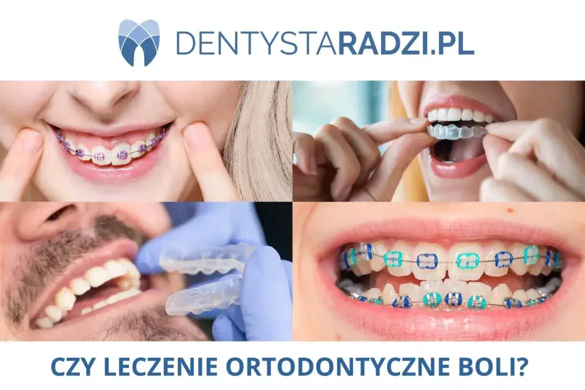 Ból zębów od aparatu ortodontycznego? 7 metod na szybką ulgę.