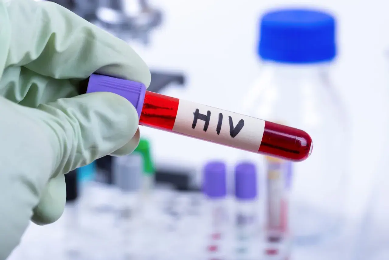 Rękawiczka ochronna trzyma probówkę z krwią oznaczoną "HIV". W tle widać sprzęt laboratoryjny, sugerujący badania nad wirusem i jego objawami u mężczyzn.
