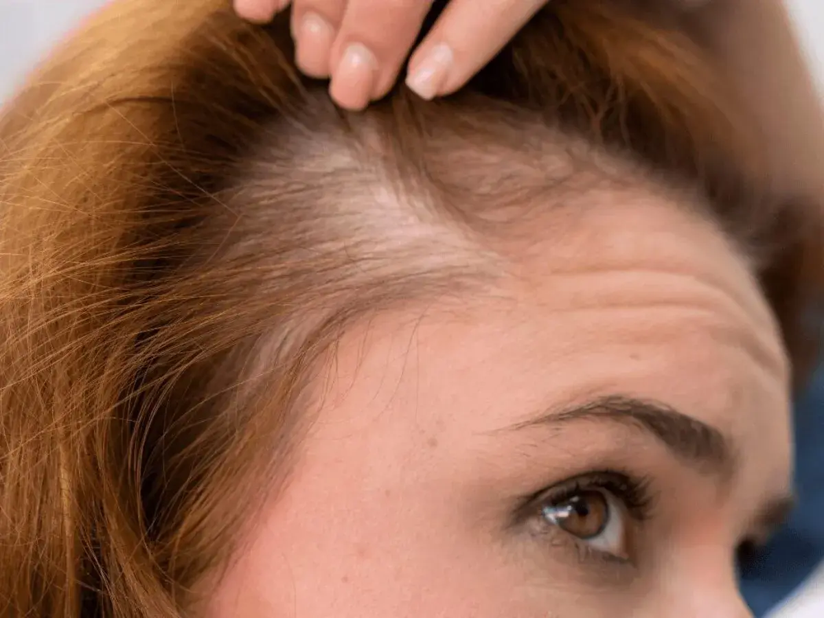 Primer plano de una mujer revisando su cuero cabelludo, preocupada por evitar la caída del cabello.