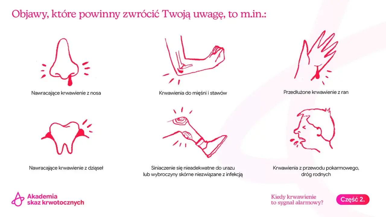 Objawy choroby von Willebranda: nawracające krwawienia z nosa, dziąseł, przedłużone krwawienia z ran, siniaki, krwawienia do stawów.