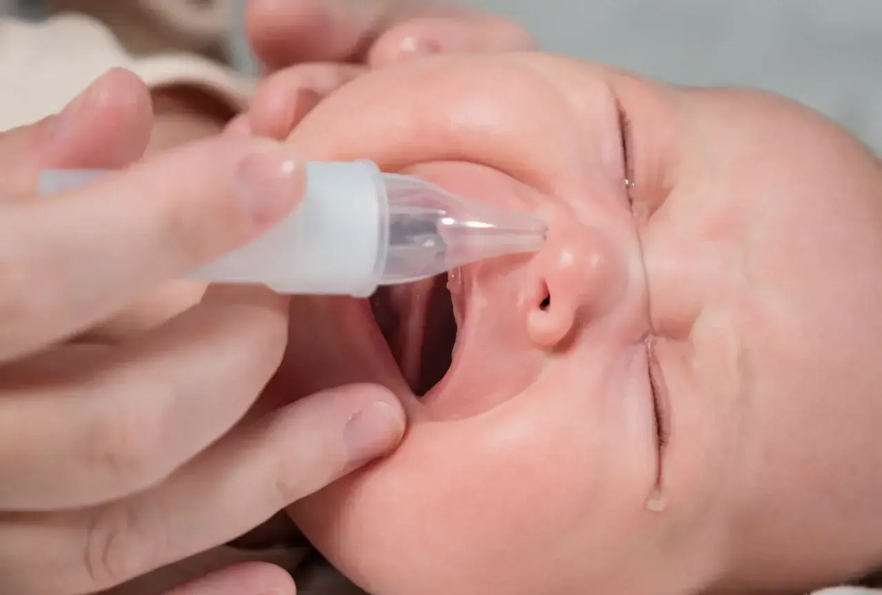 Un bebé recibe un lavado nasal con un aspirador.