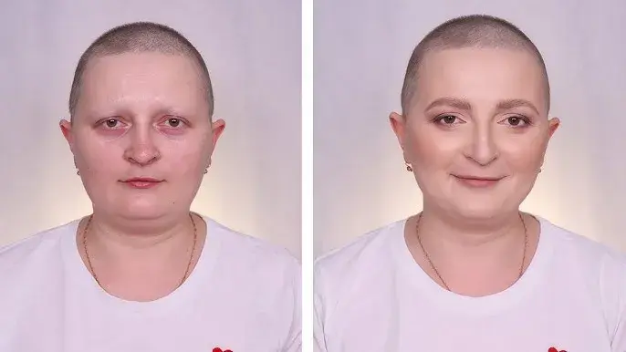 Czy po chemii wypadają brwi i rzęsy? Poznaj prawdę o skutkach terapii