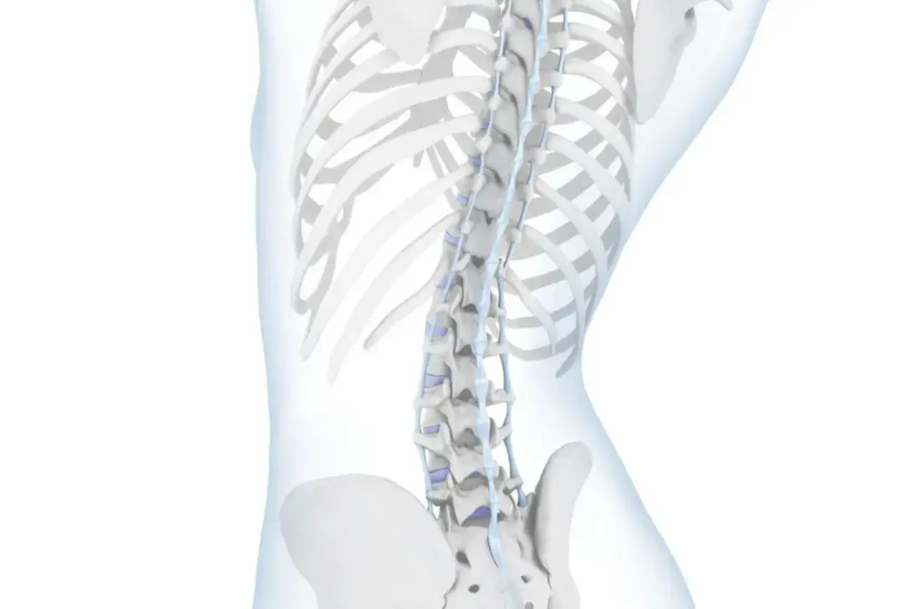Anatomia kręgosłupa z widoczną hiperlordozą, uwydatniającą nadmierne wygięcie lędźwiowe.