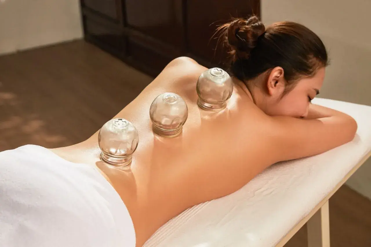 Une femme se fait soigner avec des ventouses sur le dos, une méthode de thérapie alternative pour soulager les tensions musculaires et améliorer la circulation.