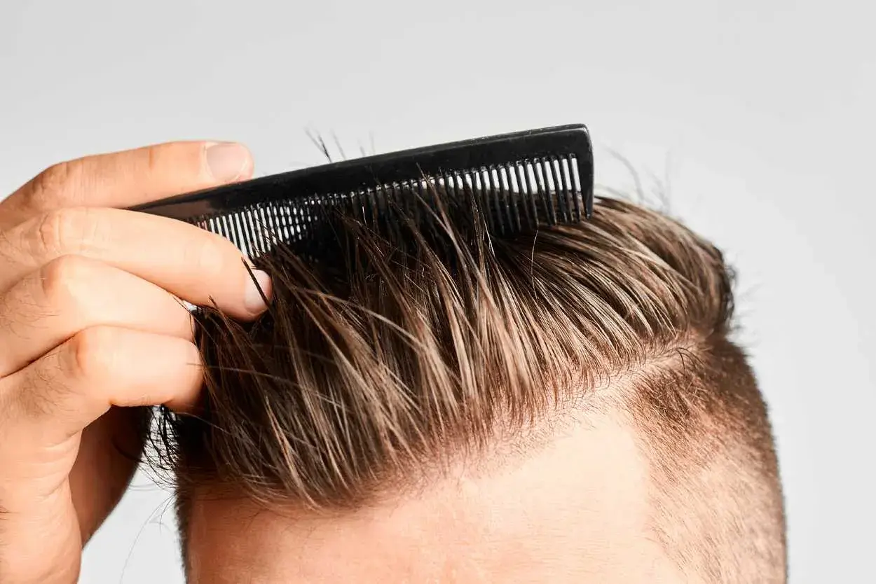 Hombre peinando su cabello, buscando recuperar pelo entradas naturalmente.