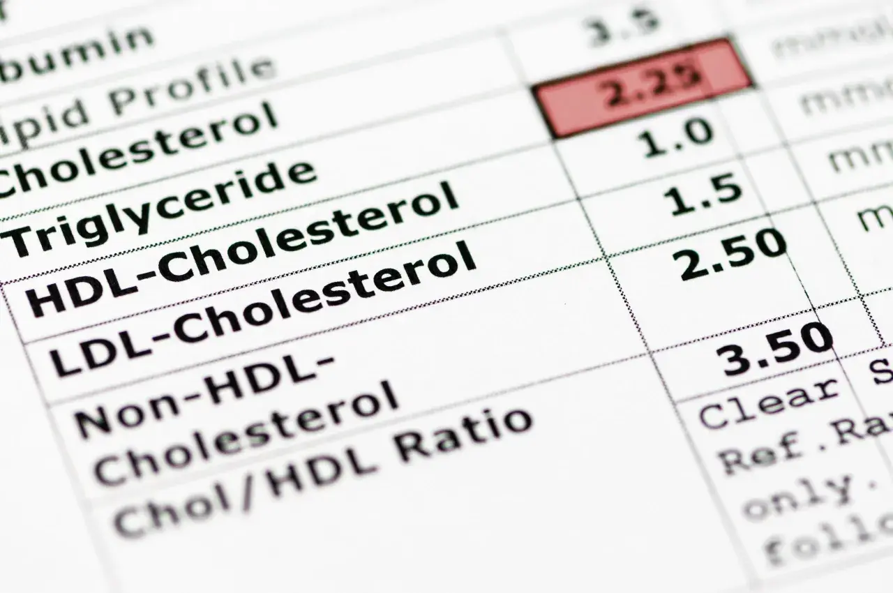 Wyniki badań krwi: cholesterol, triglicerydy. Czas oczekiwania na wyniki zależy od laboratorium.