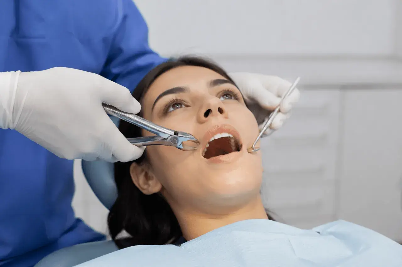 Dentista usa fórceps para sacar muelas a paciente con boca abierta.