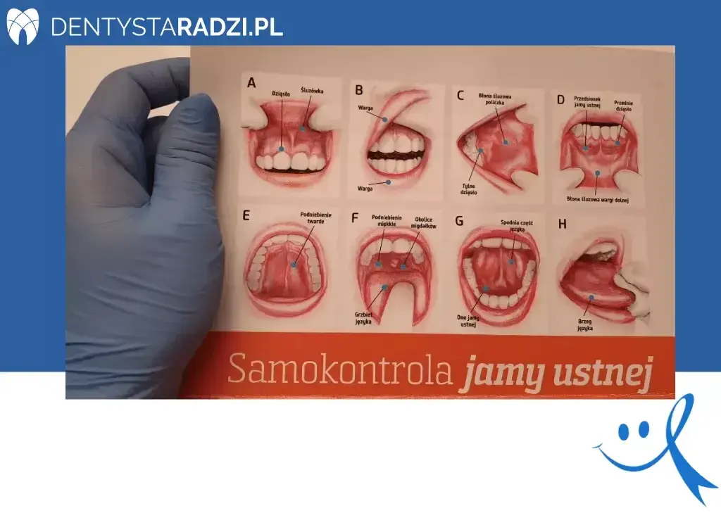 Rak dziąseł: objawy. Czy Twoje dziąsła mówią Ci coś ważnego?