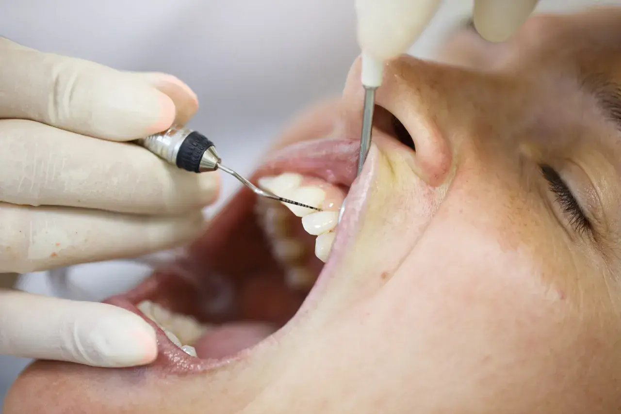 Un periodoncista que es, examina la salud de las encías y dientes con instrumental dental.