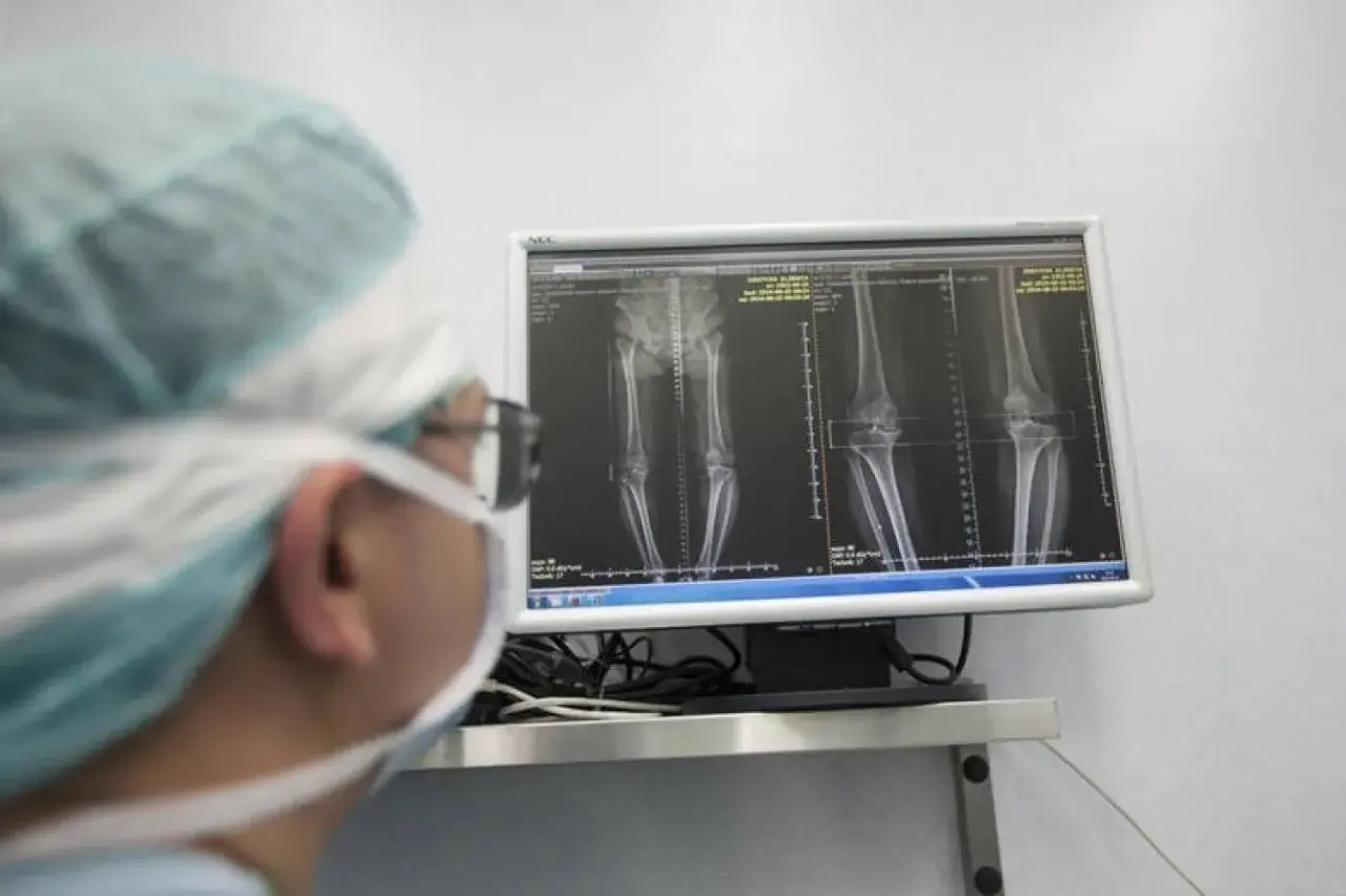 Ortopeda w masce i czepku analizuje na monitorze zdjęcia RTG kolan i kości udowych.
