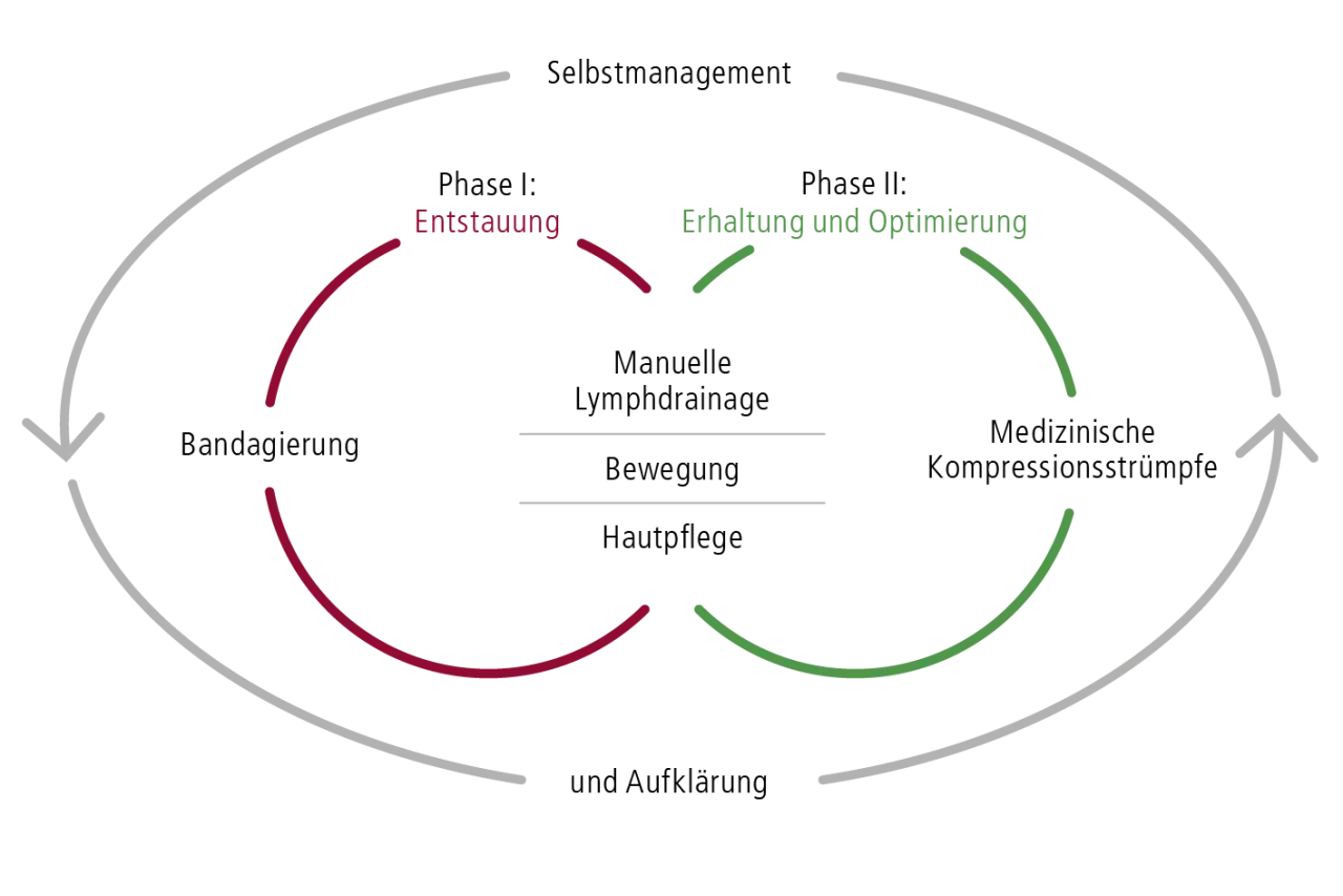Schema zeigt, wie macht man lymphdrainage: Entstauung, Erhaltung, Bandagierung, Kompressionsstrümpfe, Bewegung, Hautpflege, Selbstmanagement.