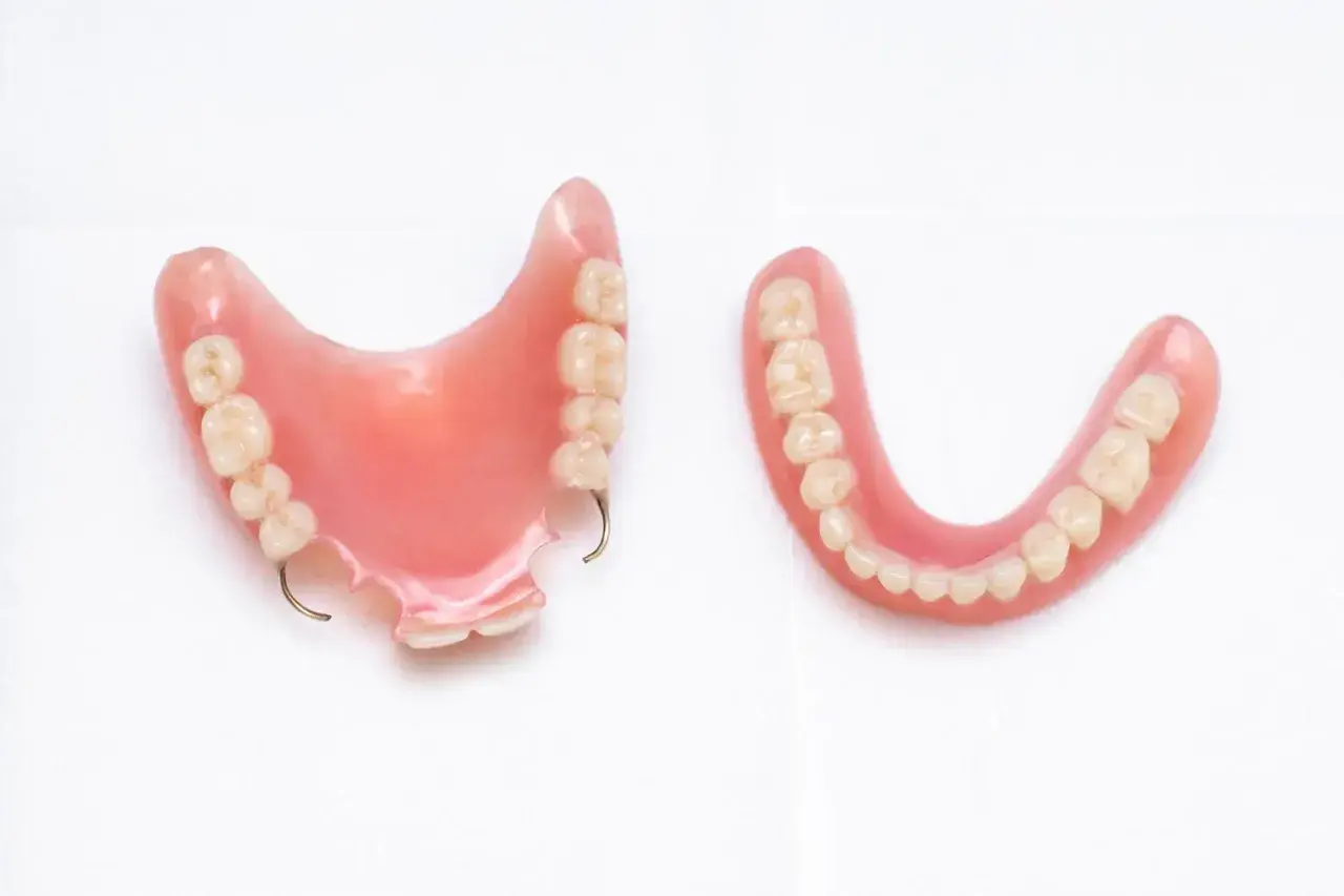 Due protesi dentali, una con ganci metallici, mostrano la soluzione di una dentiera fissa per un sorriso completo.