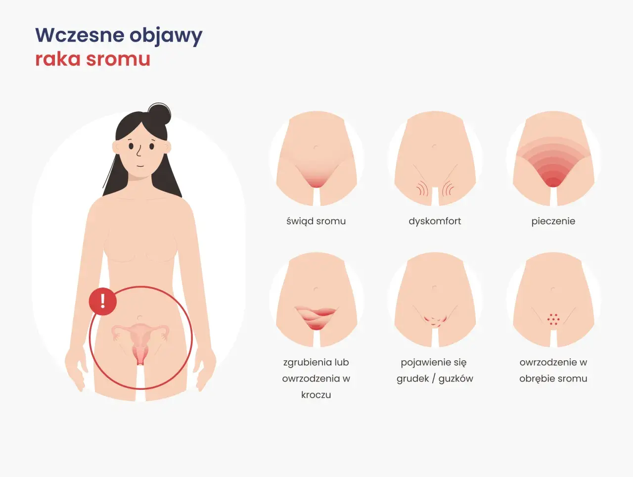 Ilustracja pokazuje wczesne objawy raka sromu: świąd, pieczenie, dyskomfort, owrzodzenia i grudki.
