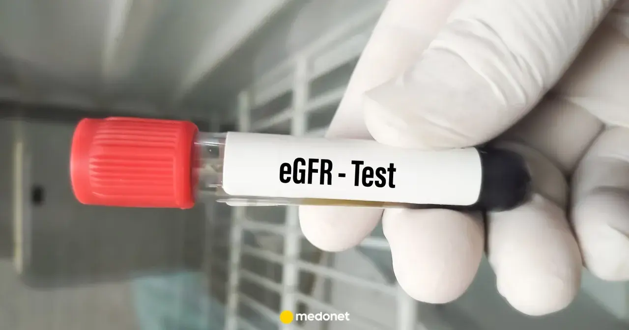 Rękawiczka trzyma probówkę z napisem "eGFR - Test". To badanie ocenia funkcję nerek.