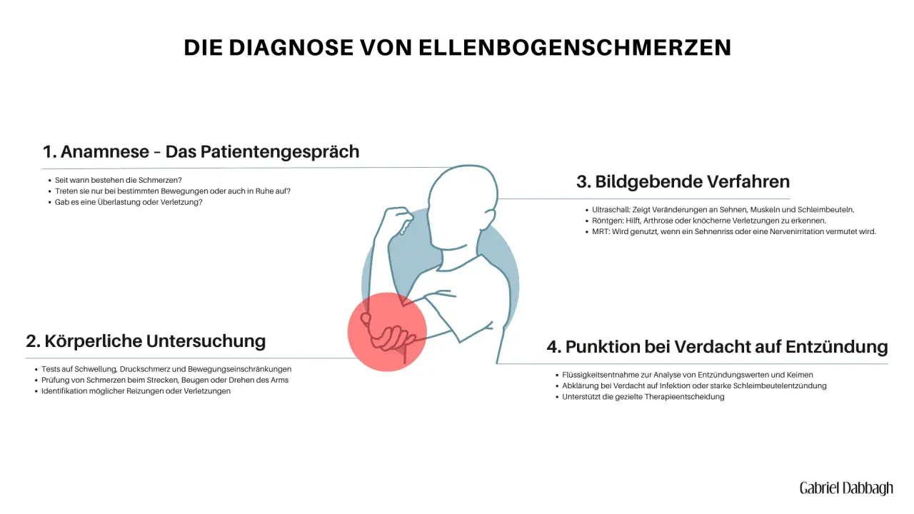 Schema zur Diagnose von Ellenbogenschmerzen, mit Fokus auf Anamnese, Untersuchung, Bildgebung und Punktion. Ein roter Kreis markiert den Bereich des capitulum humeri.