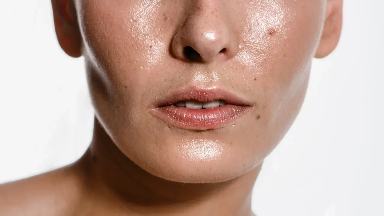 Primer plano de un rostro con piel brillante y húmeda, mostrando poros y pecas. Una imagen que inspira a buscar cómo quitar la grasa de la cara.