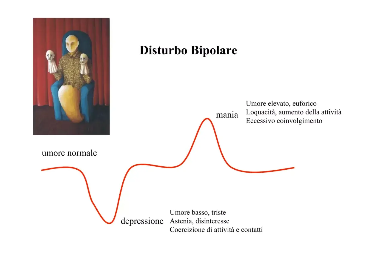 Illustrazione del disturbo bipolare tipo 1: un grafico mostra fluttuazioni dell'umore tra mania ed euforia e depressione, con un'immagine simbolica di una figura seduta con maschere.