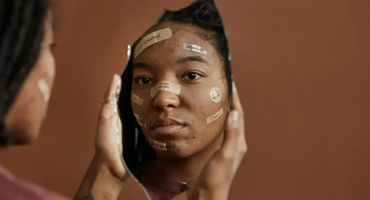 Riflesso di un volto con cerotti che recitano "acne is normal", "imperfect", "i'm not my skin", quando ti fanno sentire una nullità.