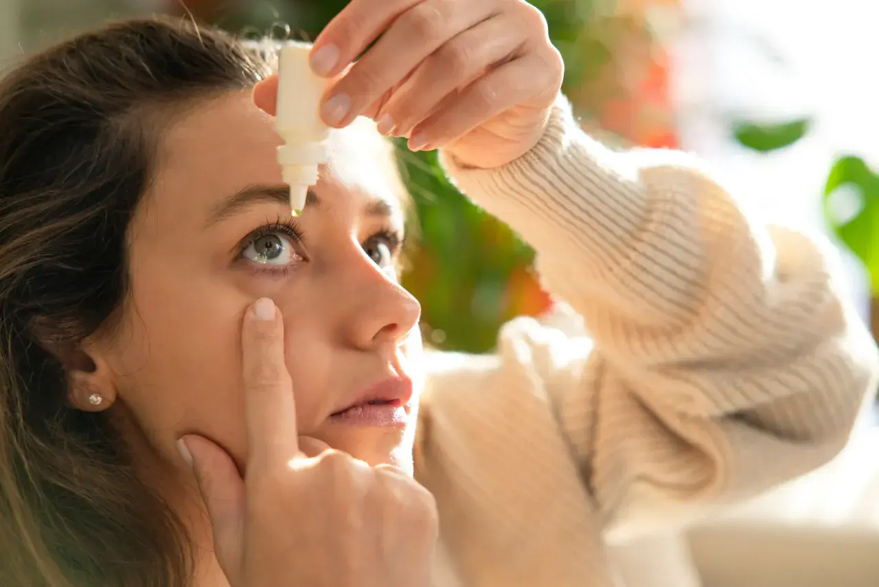 Donna applica collirio per alleviare i sintomi della congiuntivite allergica, cercando sollievo rapido.