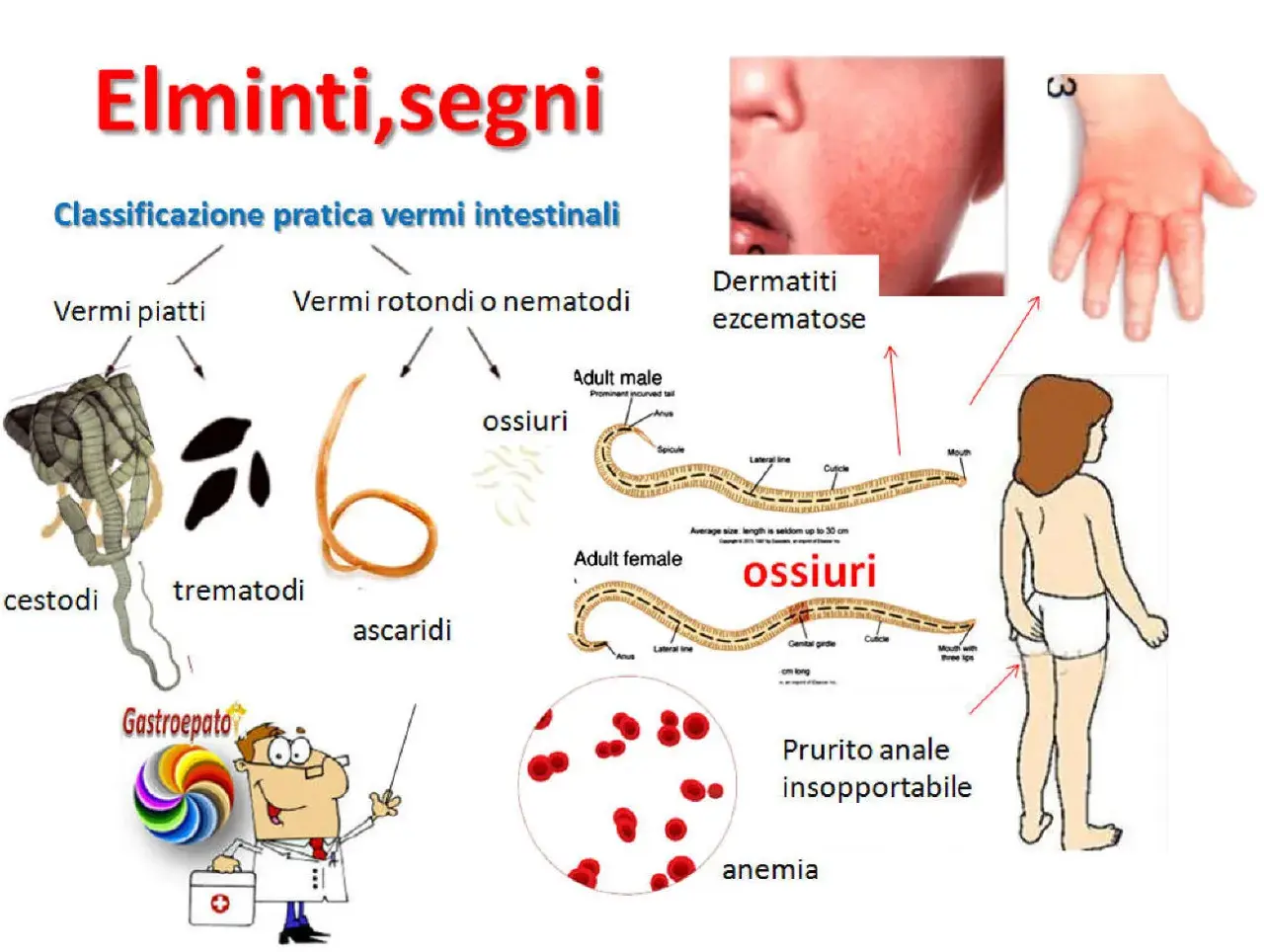 Immagine illustra vermi intestinali e i loro sintomi: dermatiti, prurito anale, anemia.
