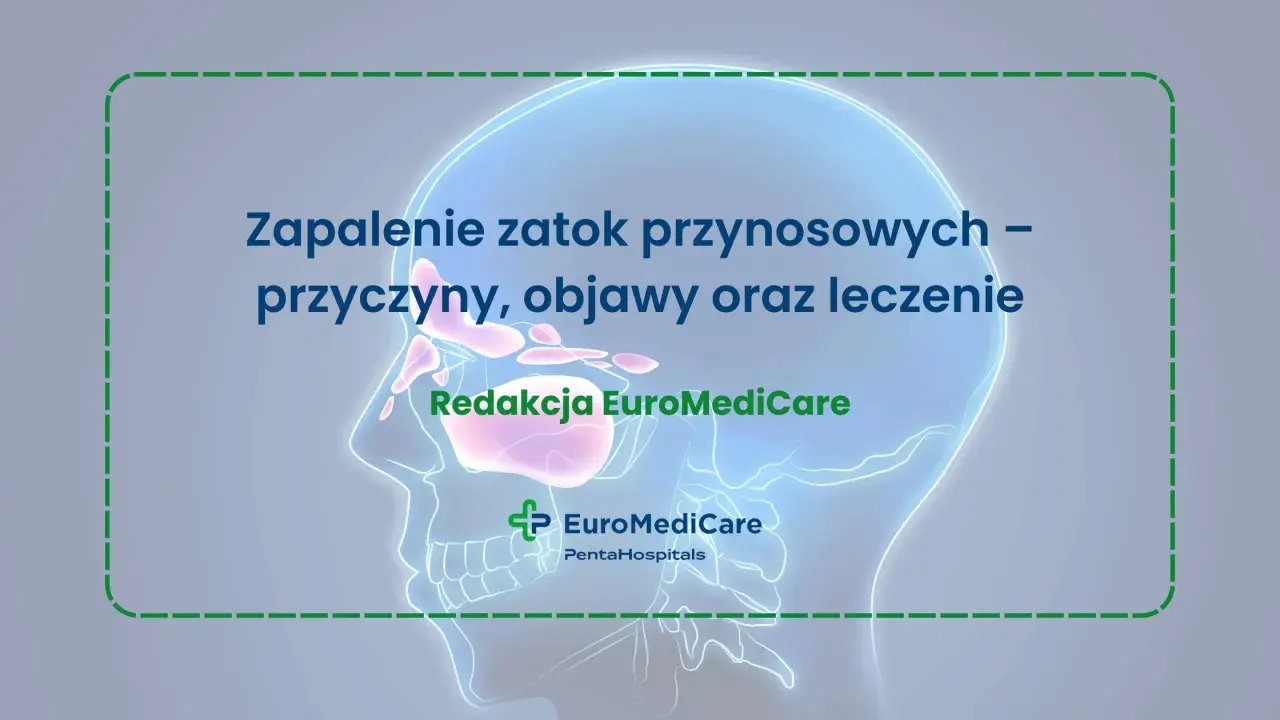 Ilustracja przedstawia schemat zatok przynosowych wewnątrz czaszki, z tekstem o zapaleniu zatok.