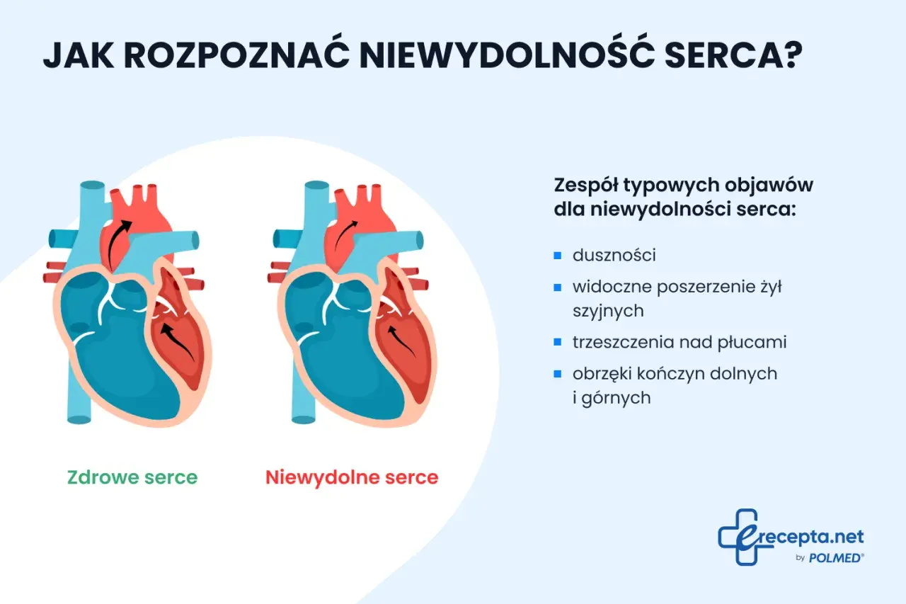 Porównanie zdrowego i niewydolnego serca. Objawy niewydolności serca: duszności, obrzęki, trzeszczenia nad płucami.