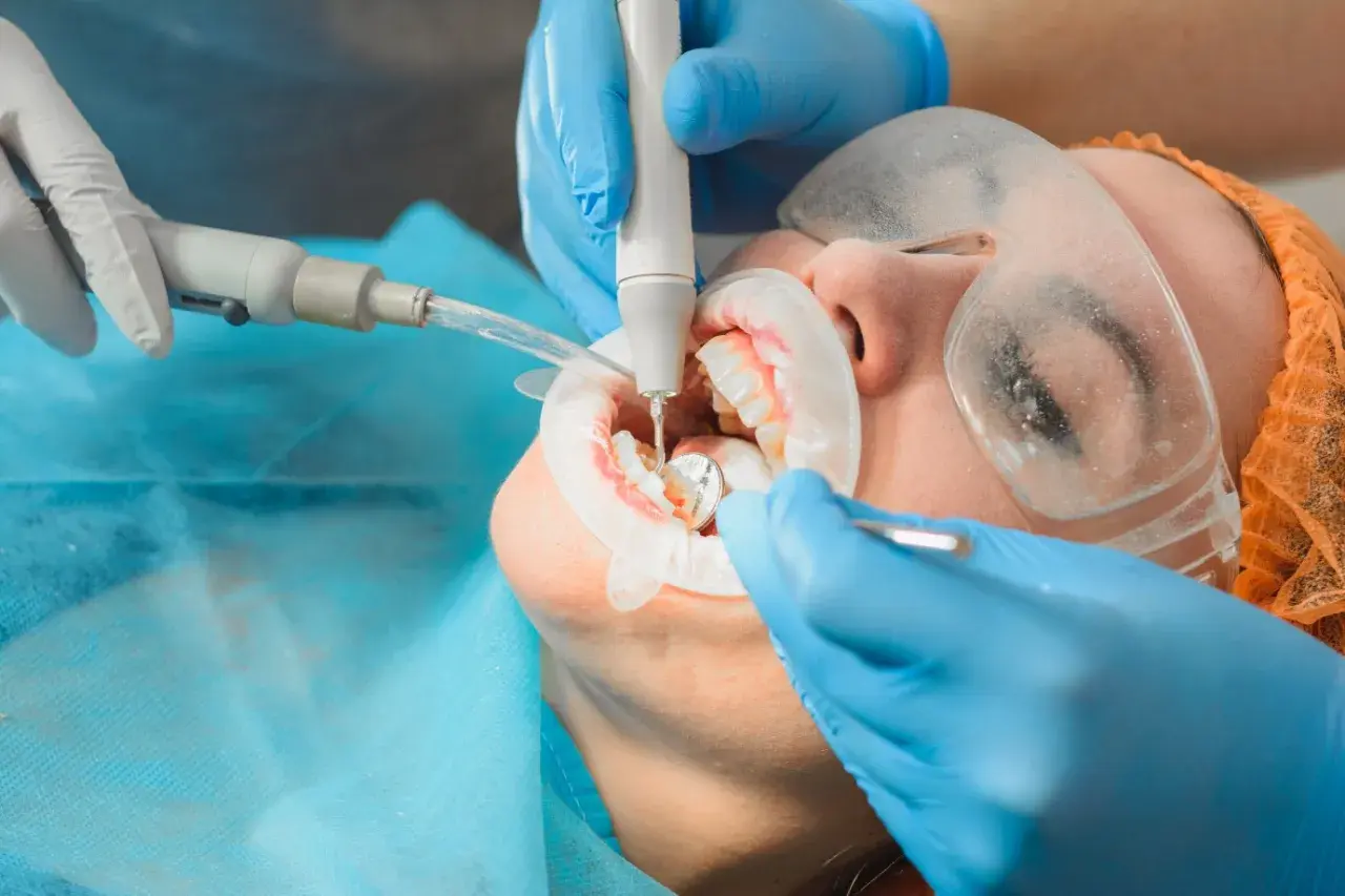 Dentysta wykonuje zabieg higienizacji zębów, usuwając kamień ultradźwiękami. Pacjent ma założony retraktor i okulary ochronne.