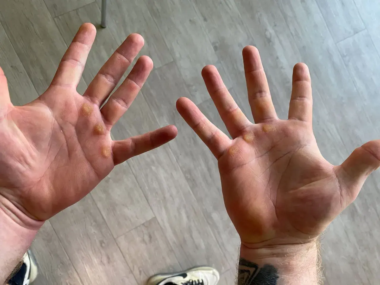 Manos con callos visibles, evidencia de trabajo duro o entrenamiento.