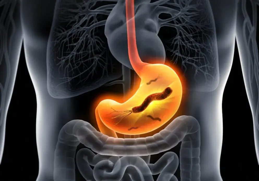 Helicobacter pylori w kale: Co oznacza pozytywny wynik testu?