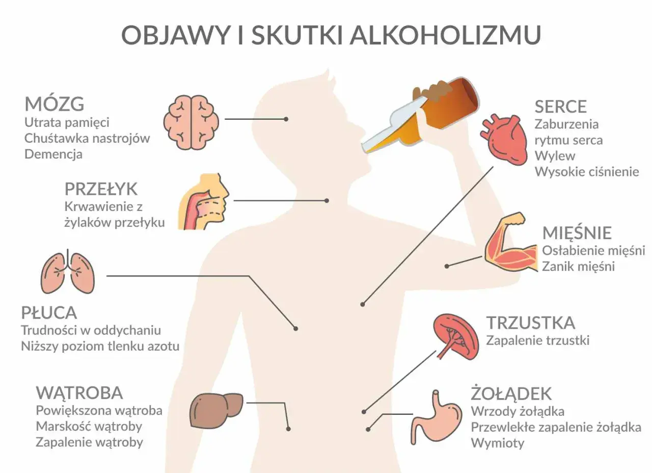 Ilustracja pokazuje skutki alkoholizmu dla mózgu, serca, płuc, wątroby, żołądka, trzustki, mięśni i przełyku.