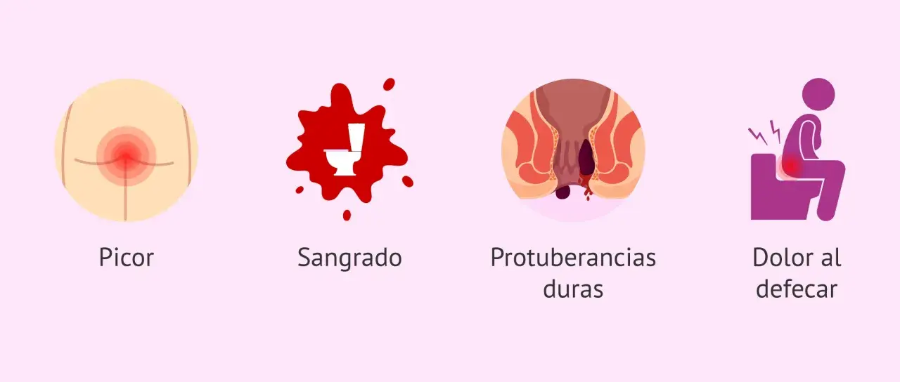 Síntomas de hemorroides postparto: picor, sangrado, protuberancias duras y dolor al defecar.