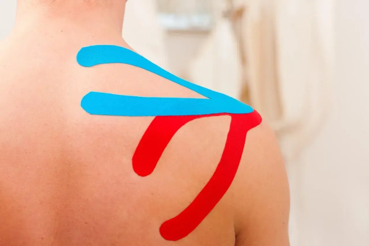 Kinesiotaping na plecach wspierający ćwiczenia na odstające łopatki. Kolory niebieski i czerwony.