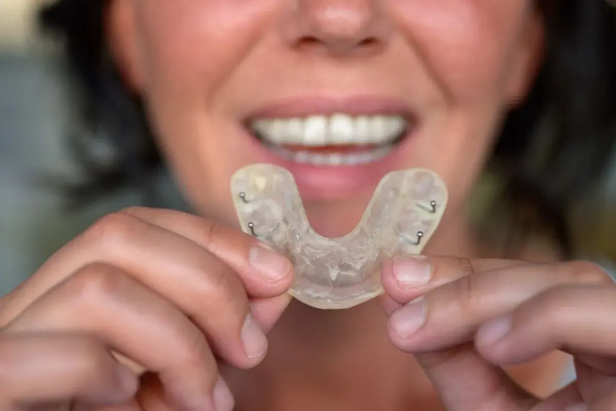 Una persona mostra un bite dentale trasparente, utile per chi tende a sbattere i denti mentre si dorme.