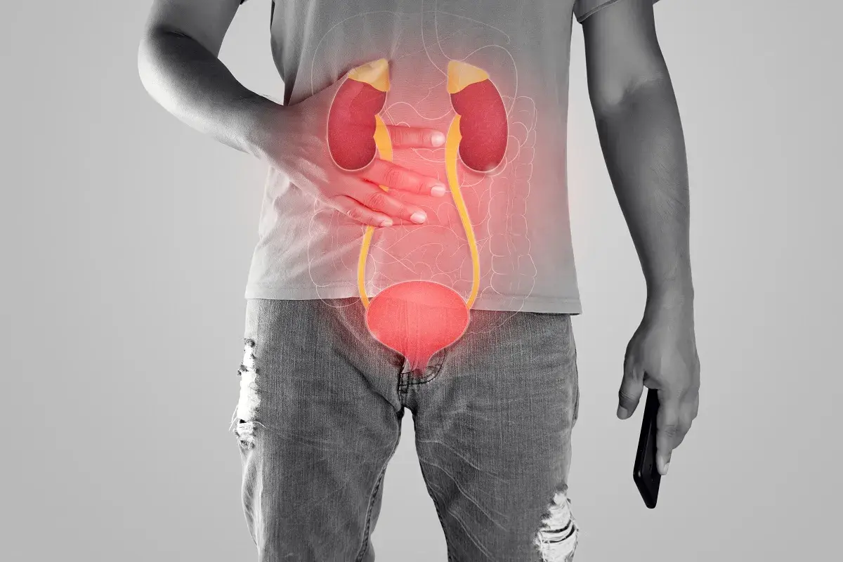 Anatomia układu moczowego z zaznaczonym bólem w okolicy nerek i pęcherza.