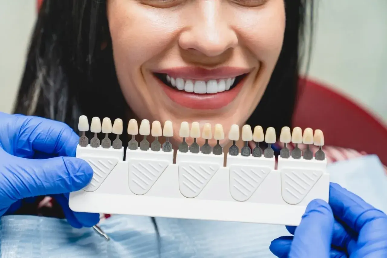 Uśmiechnięta kobieta z idealnymi zębami, dentysta dobiera odcień licówek. Dowiedz się, ile kosztują licówki na wszystkie zęby.