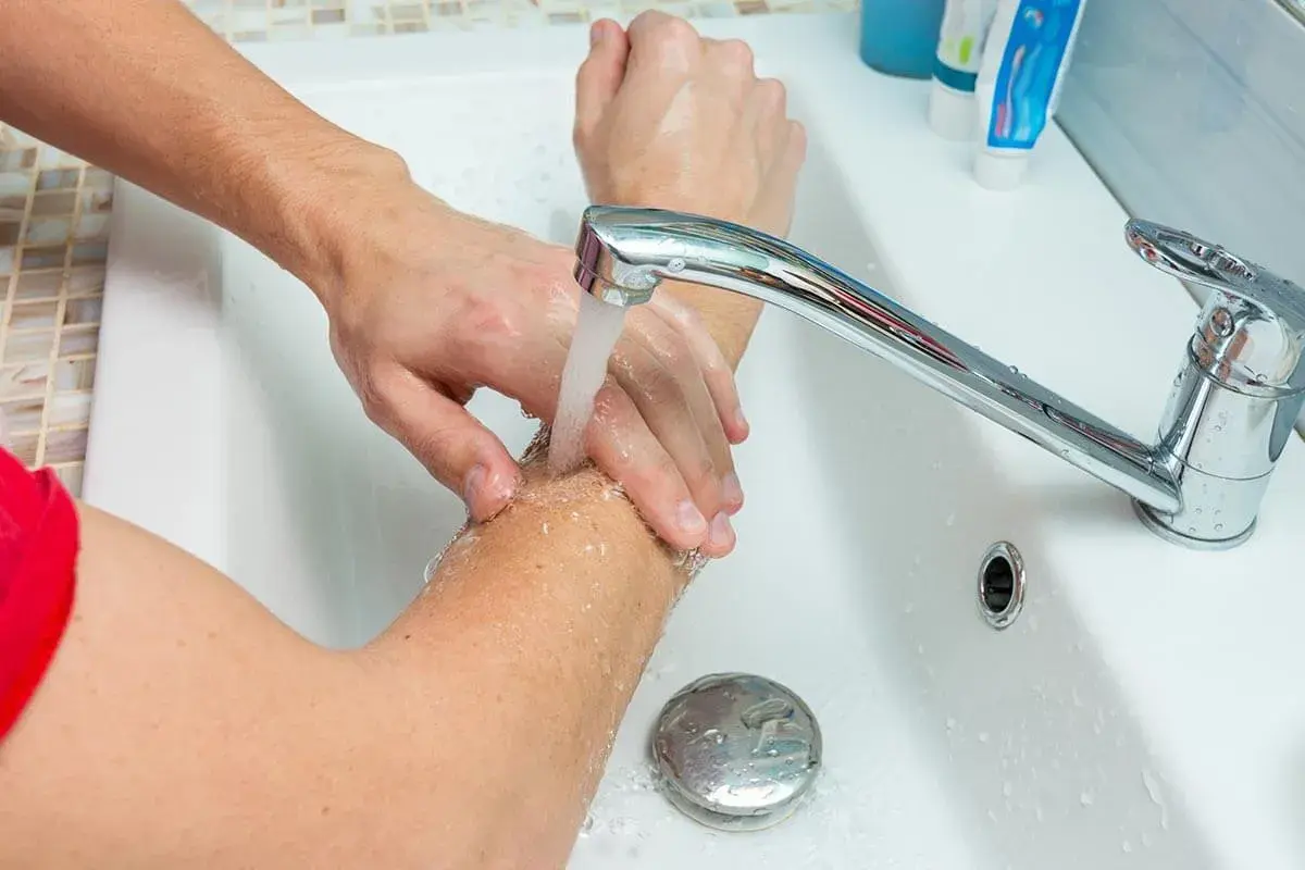 Arm unter fließendem Wasser kühlen. Bei einer Brandblase sofort handeln: Kühlen ist das Wichtigste.