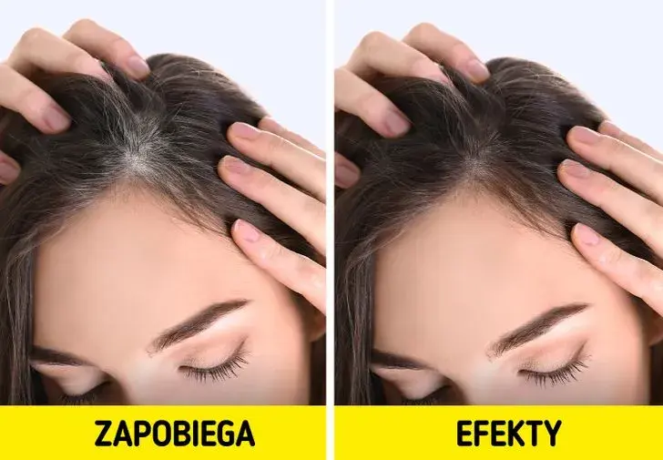 Jak zapobiec siwieniu włosów – skuteczne metody i naturalne sposoby na młodszy wygląd