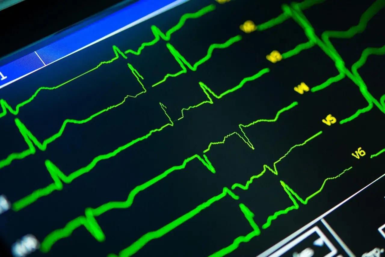 Zielone linie na czarnym ekranie pokazują zapis ekg serca, analizę pracy serca.