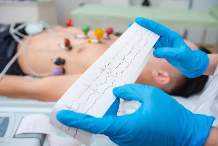 Czy nerwica serca wyjdzie na EKG? Co musisz wiedzieć o objawach