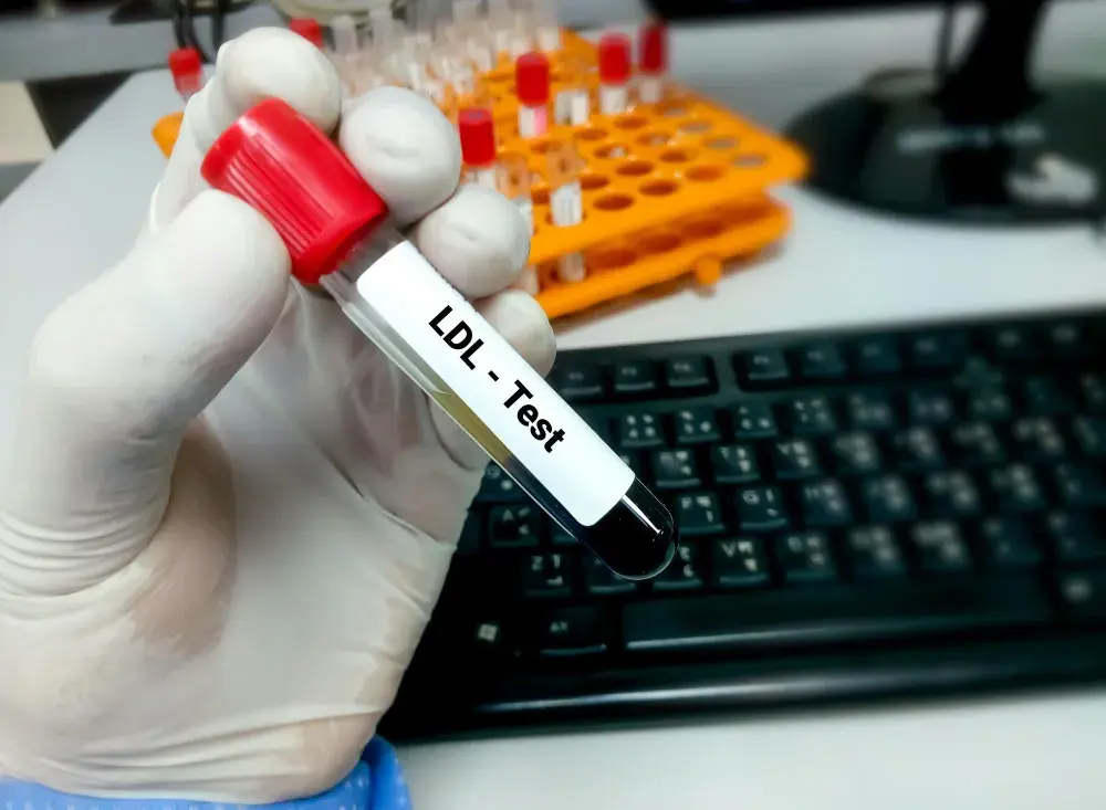 Jak bezpiecznie podnieść cholesterol? Sprawdź skuteczne metody i porady