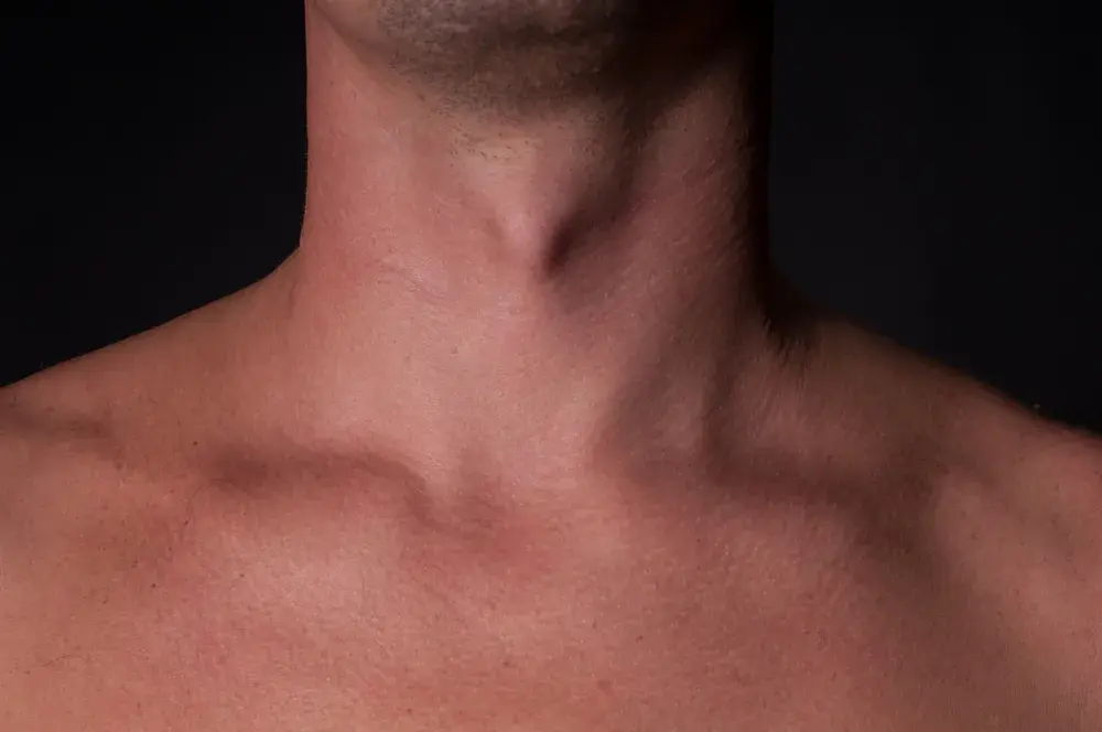 Jabłko Adama u mężczyzn - poznaj prawdę o tej męskiej cesze anatomicznej