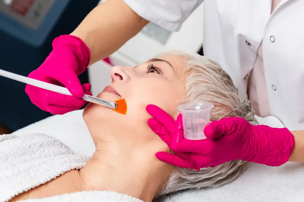 Peeling chemiczny co to? Odkryj korzyści i skutki uboczne zabiegu
