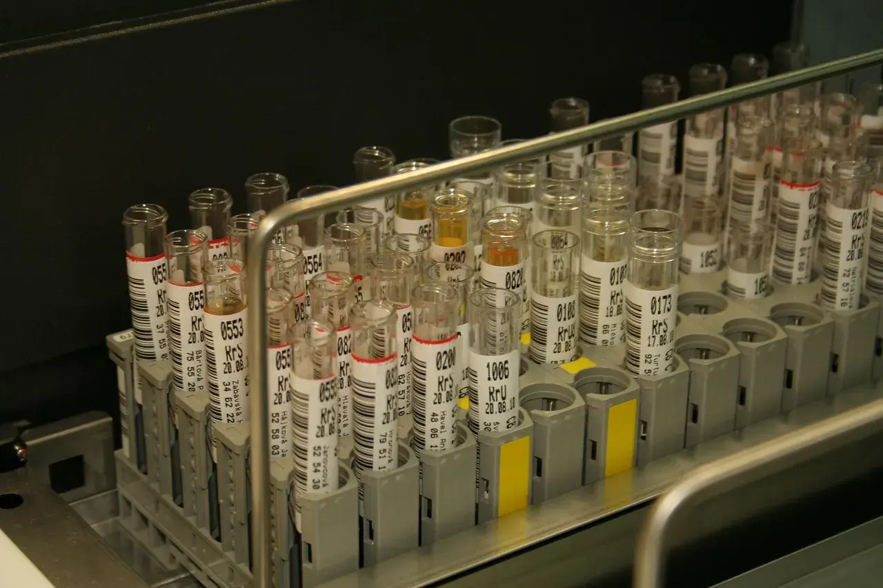 Nie każda probówka jest taka sama. Jak wybrać odpowiednią do profesjonalnego laboratorium?