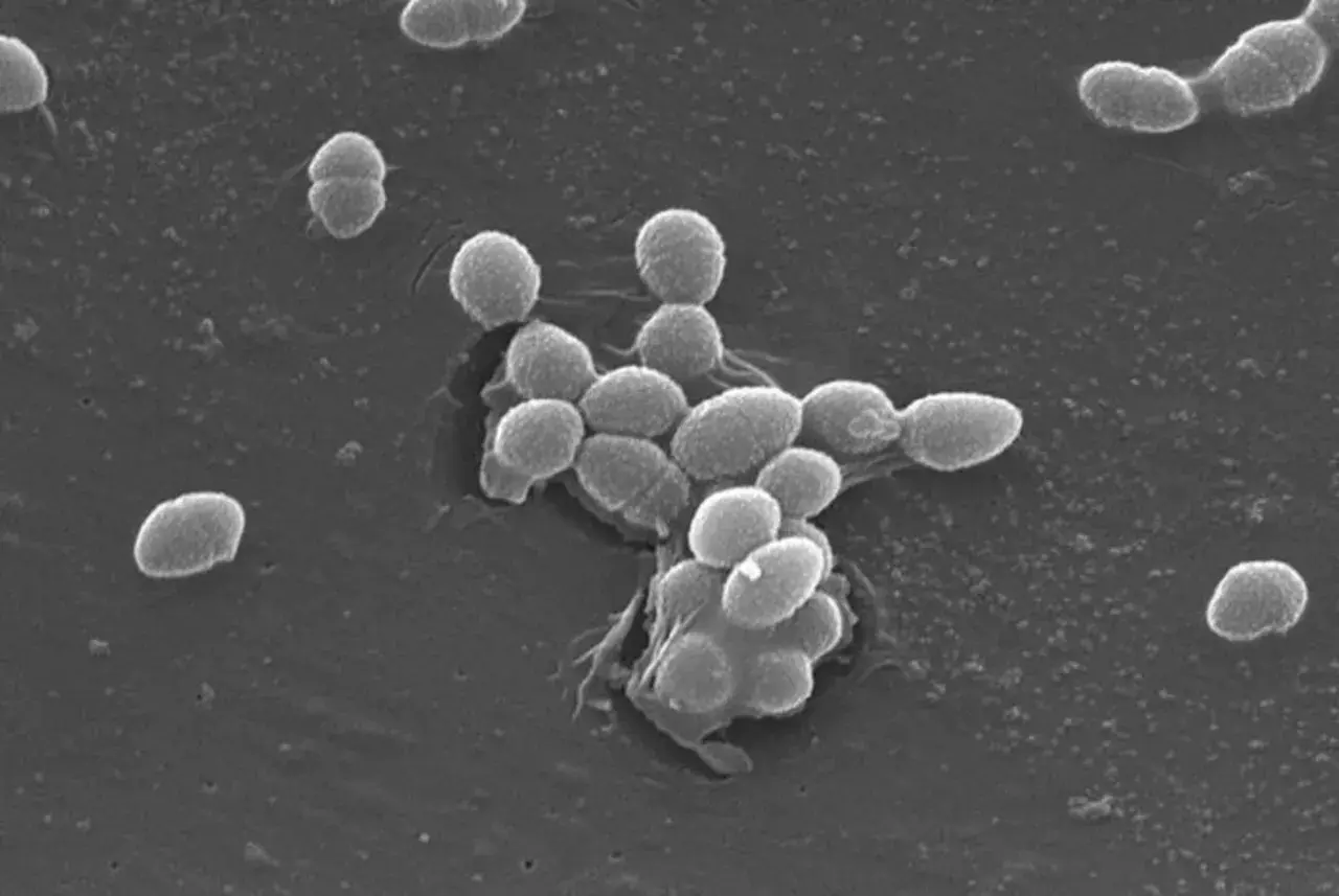 Enterococcus faecalis w moczu: Jak leczyć? Skuteczne metody