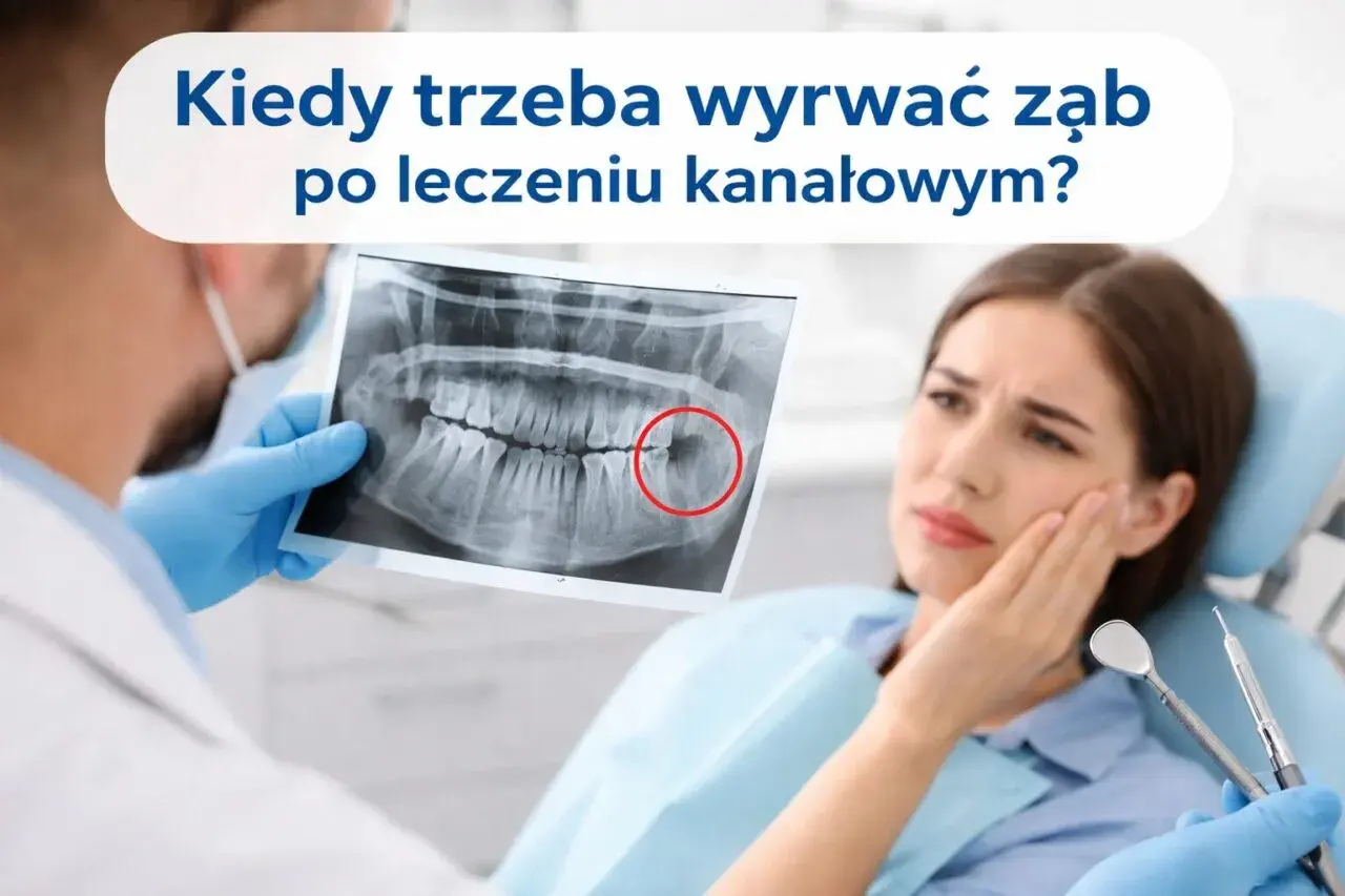 Dentysta pokazuje pacjentce prześwietlenie zęba, wskazując na problem. Kiedy trzeba rozważyć usuwanie zębów leczonych kanałowo?