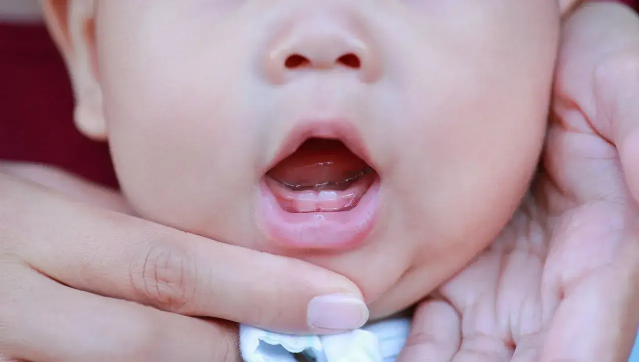Bocca di neonato con primi dentini spuntati. La dentizione neonato è un momento emozionante per i genitori.